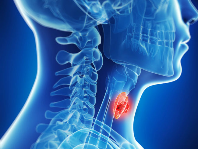 Thoracic Cancer Program