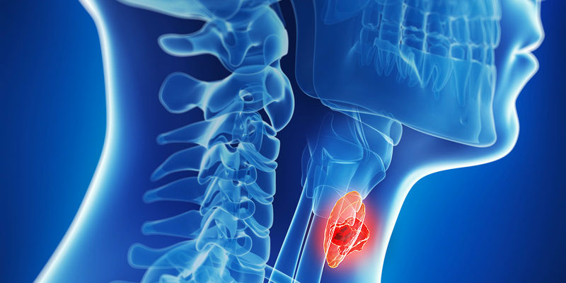 Thoracic Cancer Program