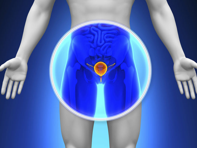 Urologic Cancer Program